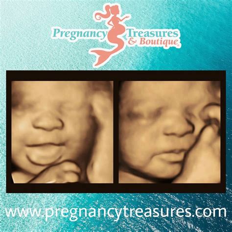 pregnancy treasures|beach baby ultrasound.